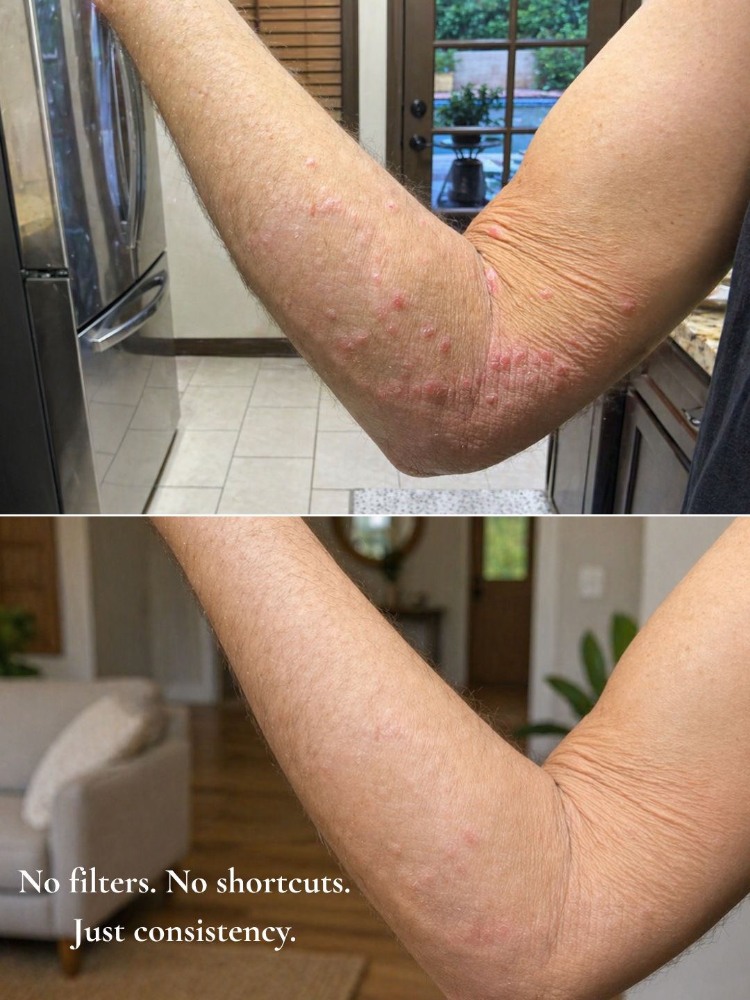 The Healer - Barrier Repair Balm for Dry, Sensitive & Irritated Skin