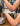 a person with rash on their arm