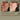 Before and after comparison of skin consistency on a person's face with text 'The Difference Consistency Makes'.